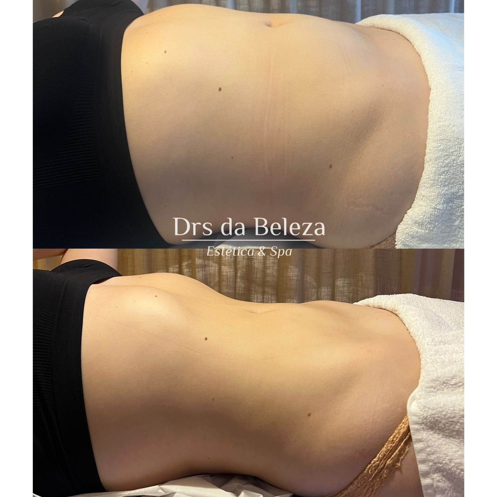 Antes e Depois 2